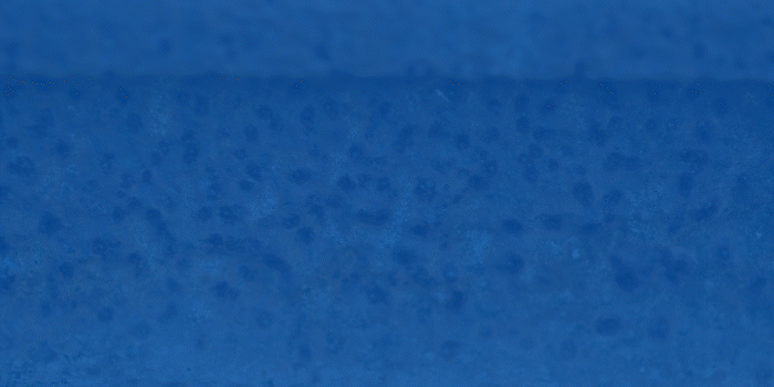 Graphic image comparing pitting corrosion and crevice corrosion in stainless steel